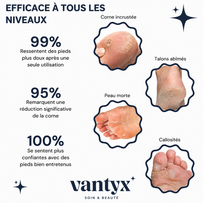 Râpe Anti-Callosités Vantyx™ PRO