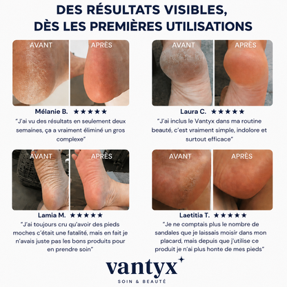 Râpe Anti-Callosités Vantyx™ PRO