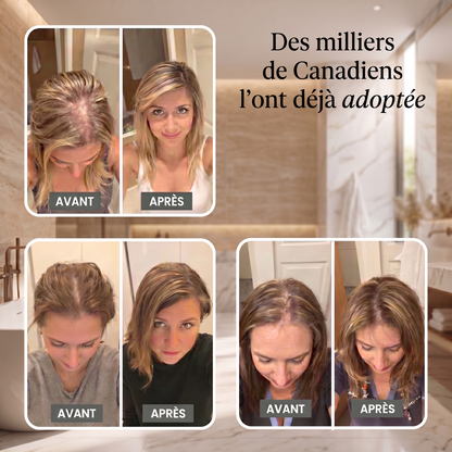 Tête de Douche Filtrante Vantyx